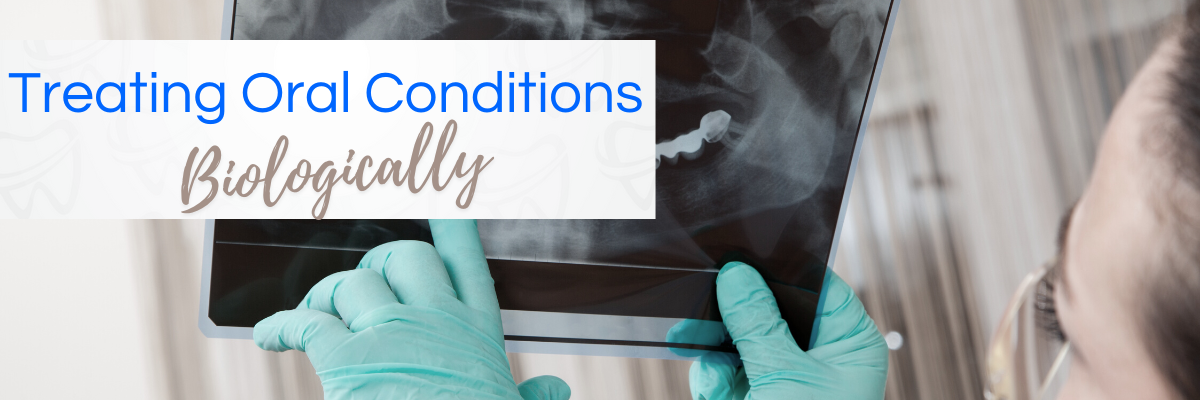 Featured image for “Treating Oral Conditions Biologically”